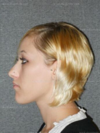Melissa A Schultz