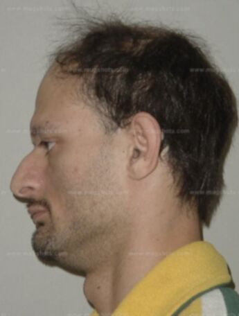 Timothy J Scales