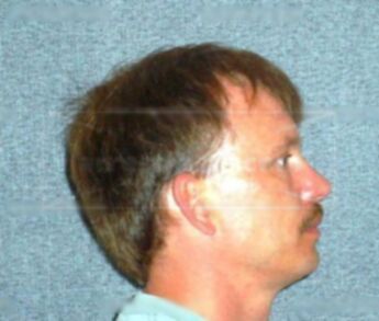 Matthew J Boileau