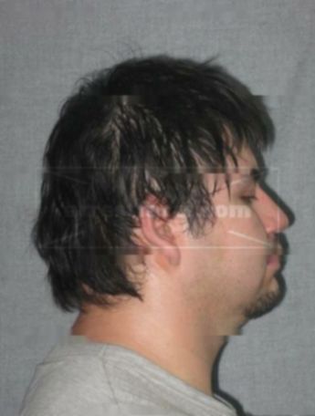 Peter A Kratz
