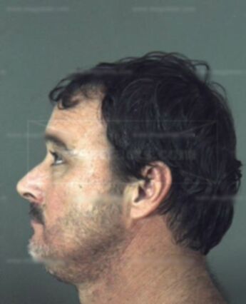 Robert David Angle