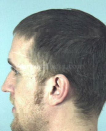 Randall William Pfettscher Ii