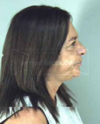 Anna D Lefave