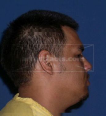 Joel Lopez
