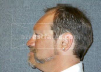 Jeffrey M Kierszh