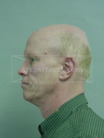Robert B Hoehle