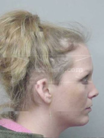 Kirsten L Burger