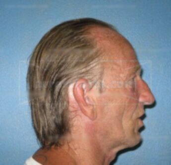 Tommy L. Ring