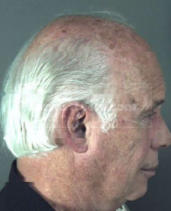 Donald Nelson Dickson