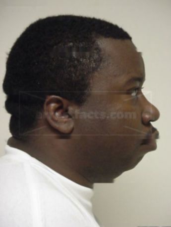 Raymond D Mckinnie