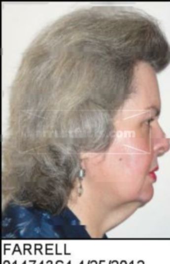 Terri Masingale Farrell