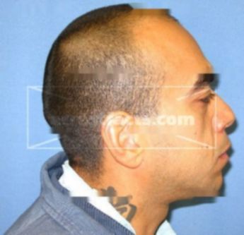 Leonardo Ibarra