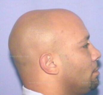 Anthony Ortiz