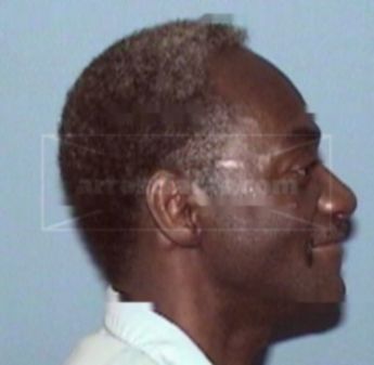 Willie Hearn Iii