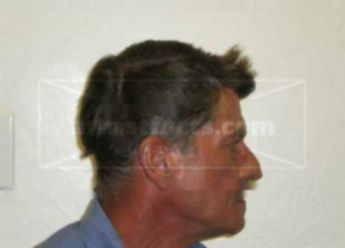 Dennis D Kidder