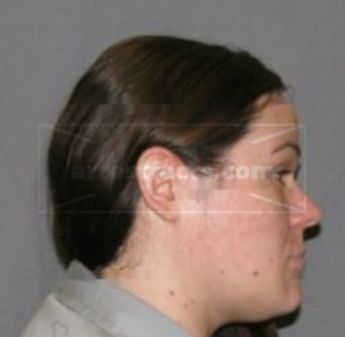 Chelsea Lee Case