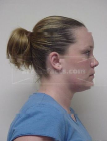 Heather M Glaesner