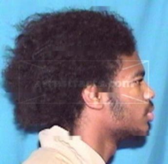 Lionell L Harris