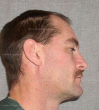 Jay G Eschmann