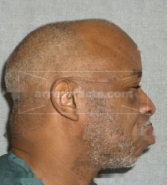 Myron Williams