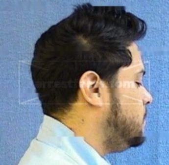 Alejandro Hernandez