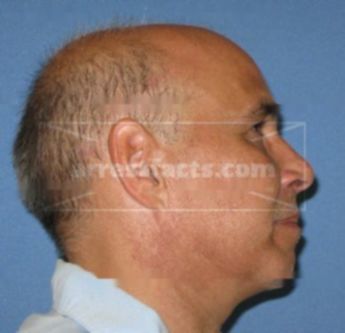 Jose Angel Franco