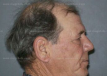 Ronald Gene Simpson