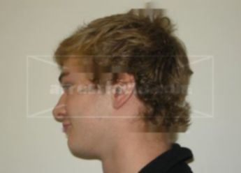 Landon J Kozel