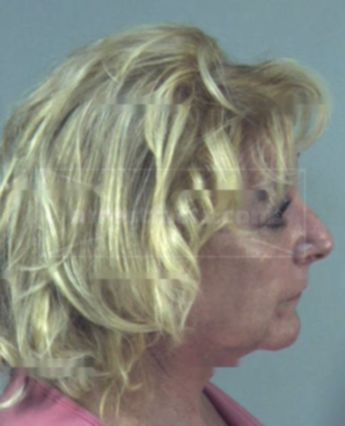 Lisa Wendell Schroth