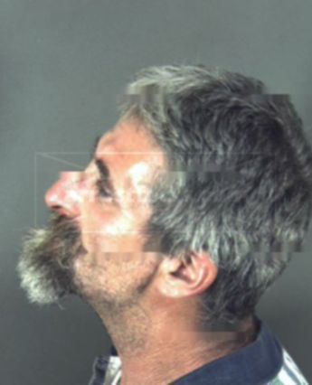 Michael Gale
