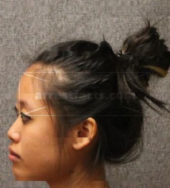 Lilian Fong
