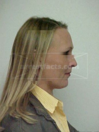 Angela F Northam