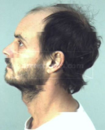 Chad Donald Laws