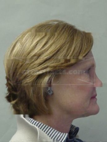 Susan A Kane