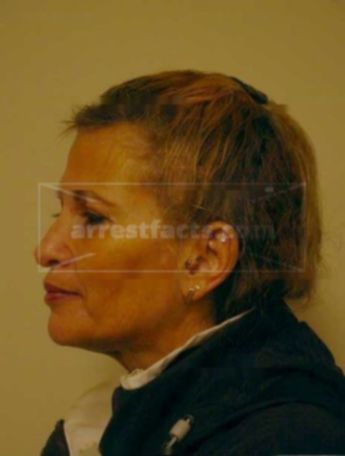 Lynn A Johnston