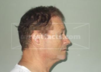 Terry R Klingenmeyer