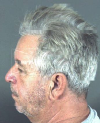 Charles Henry Mitchell