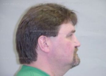 Gary L Laviolette