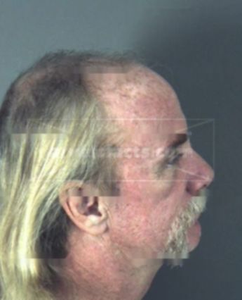 William Anthony Hubbard