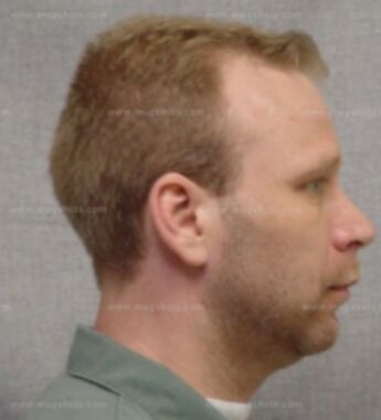 Tommy Riddle