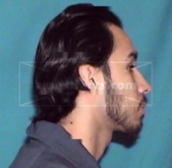 Jonathan Herrera