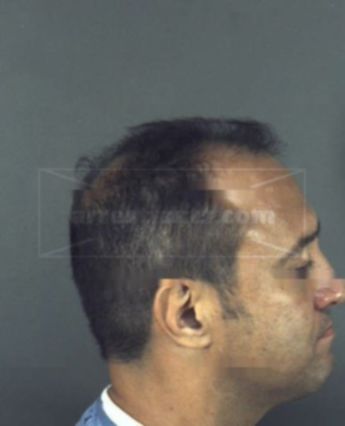 Anthony Joe Milo