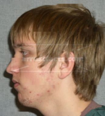 Tyler J Brandenburg