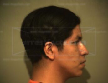 Rudy Ledezma Beraza