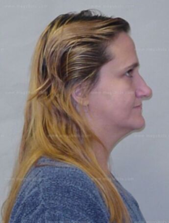 Teresa Chojnacki