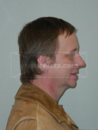 Timothy J Forst