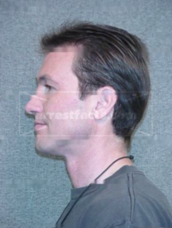 Robert J Zinck