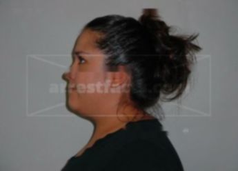 Toni M Hernandez