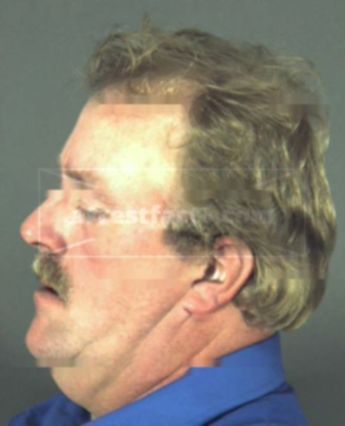 James Thomas Edwards