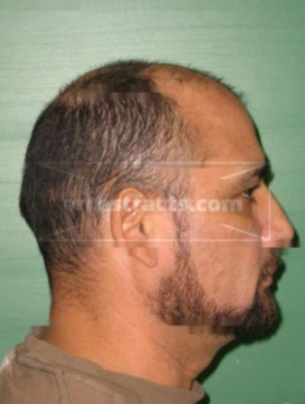 Andres Martinez